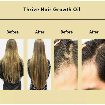 Hair Thrive Growth System